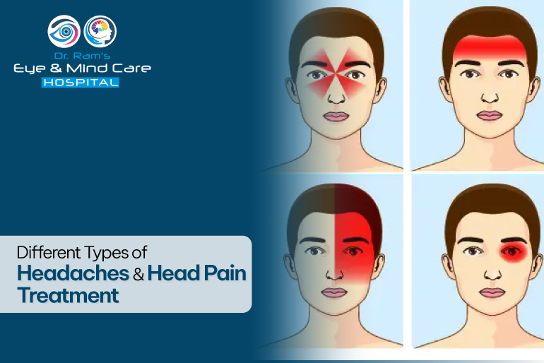 Types of Headaches